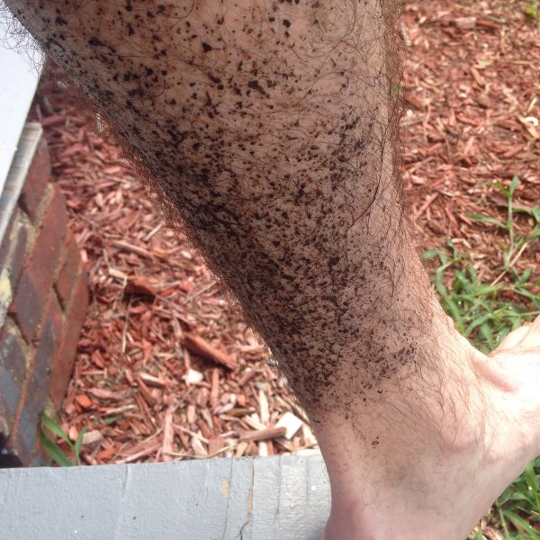 A case of trail runner's leg